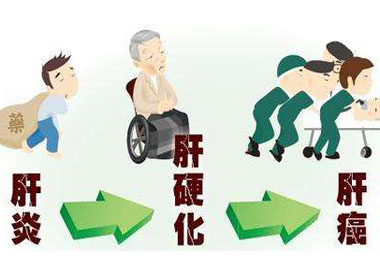 四種不良生活習(xí)慣傷肝 保肝護(hù)肝每天堅持補(bǔ)點它