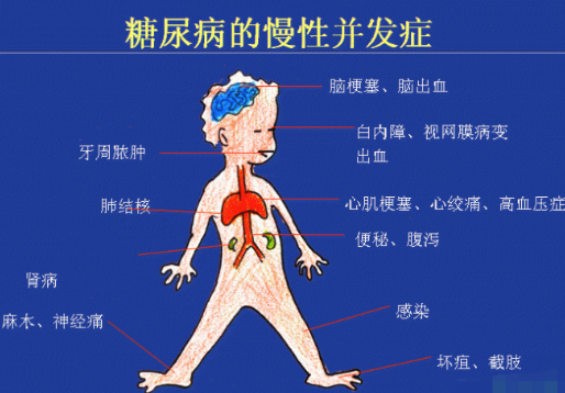 你還在害怕糖尿病嗎？科學補硒不“恐糖”
