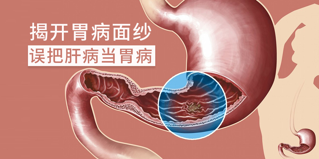 警惕“假胃病”，小心是肝有問題